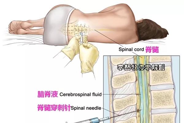 腰椎穿刺解剖层次图片